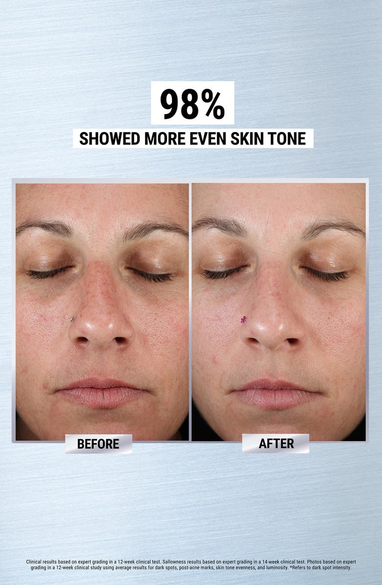 Kiehl's Since 1851 Brighten & Correct Duo (Nordstrom Exclusive) $310 Value, Alternate, color, 