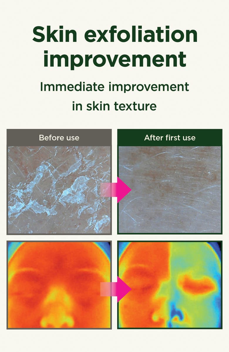 CKD Retino Collagen Small Molecule 300 First Essence, Alternate, color, 