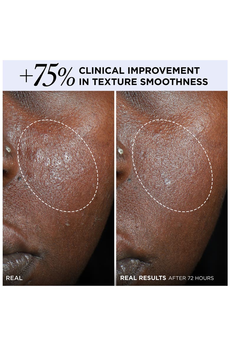 Confidence in a Cream® Barrier Boost Skin Repair Daily Moisturizer, Alternate, color, NO COLOR