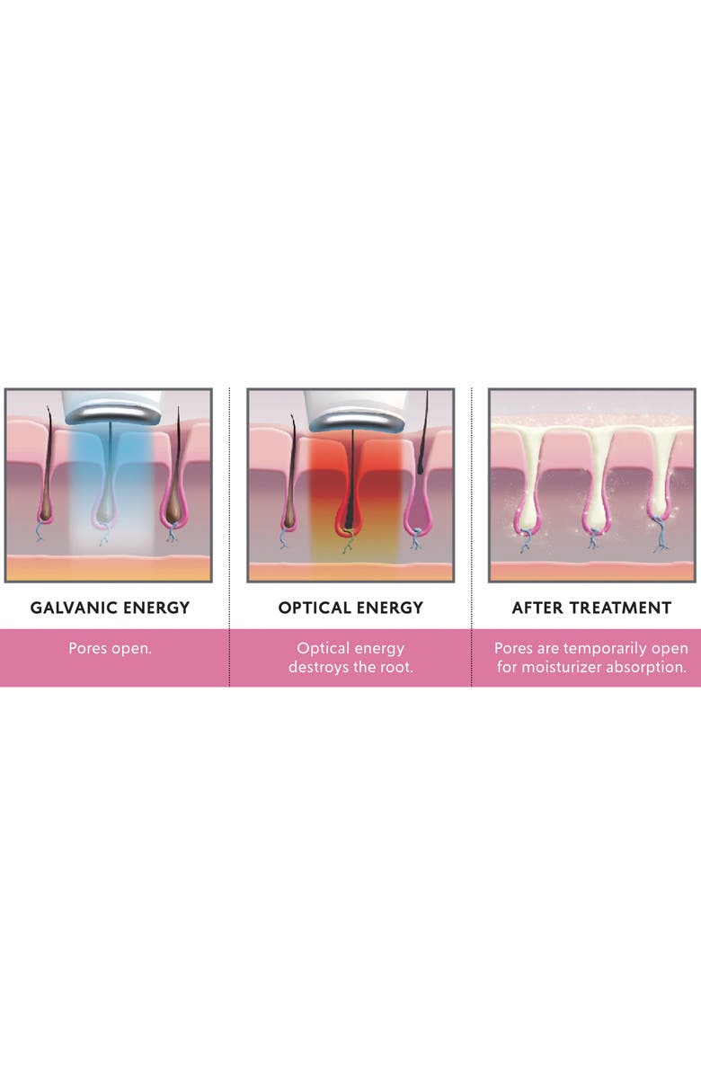 Silk'n Infinity Hair Removal Device, Alternate, color,