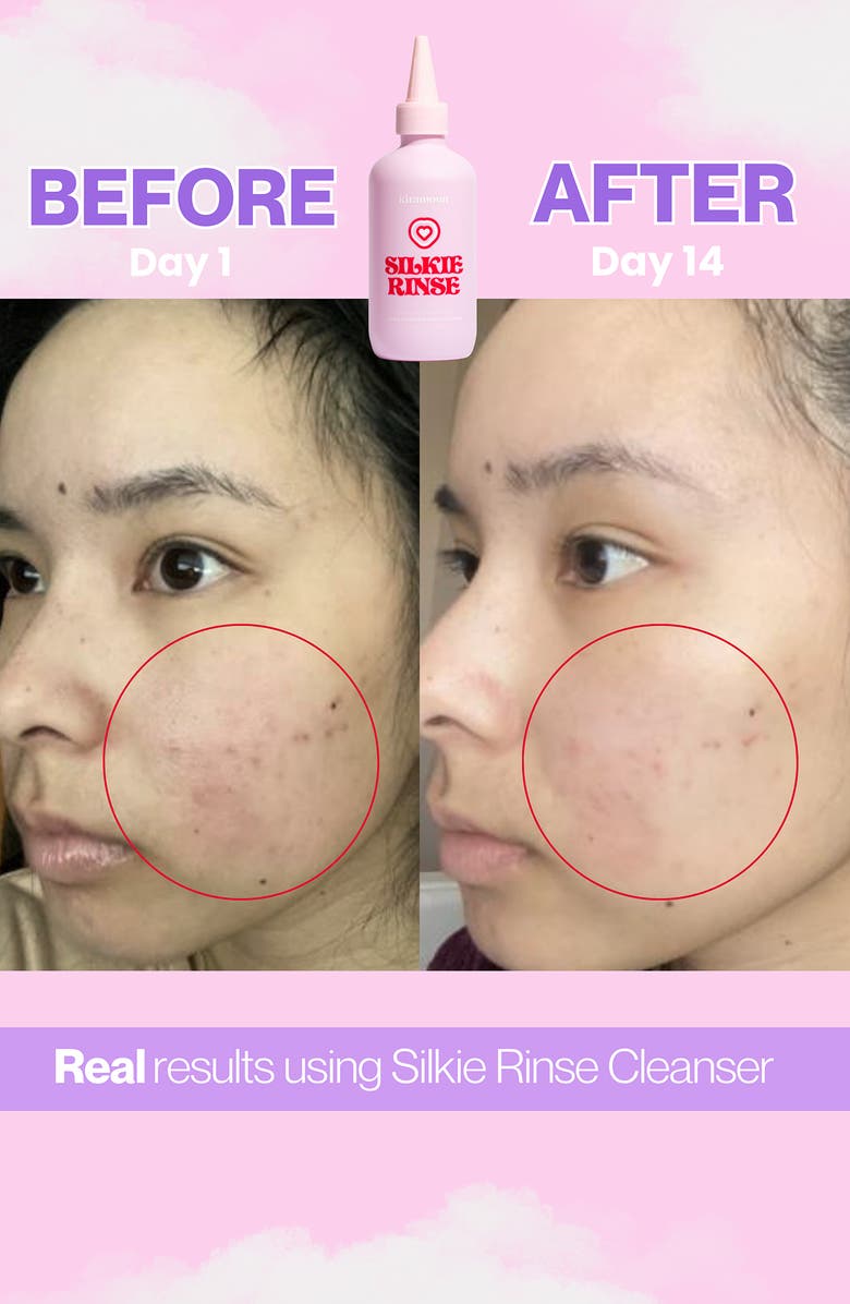 Kiramoon Silkie Rinse Gentle Hydrating Facial Cleanser, Alternate, color, Pink