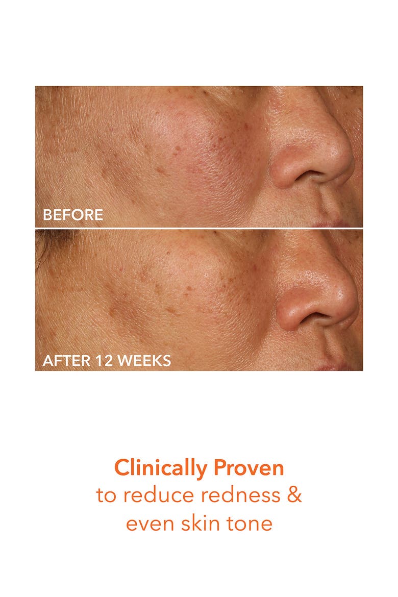 Vitamin C Lactic 15% Firm & Bright Serum, Alternate, color, NO COLOR