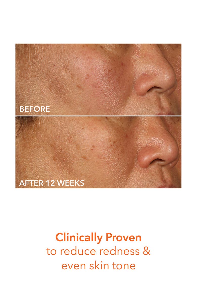 Dr. Dennis Gross Skincare Vitamin C Lactic 15% Firm & Bright Serum, Alternate, color, 