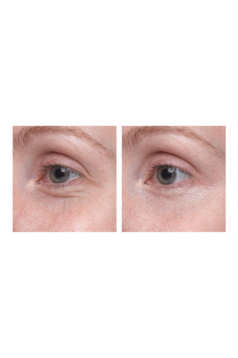 Visionnaire Yeux Eye on Correction® Advanced Multi-Correcting Eye Balm, Alternate, color, NO COLOR