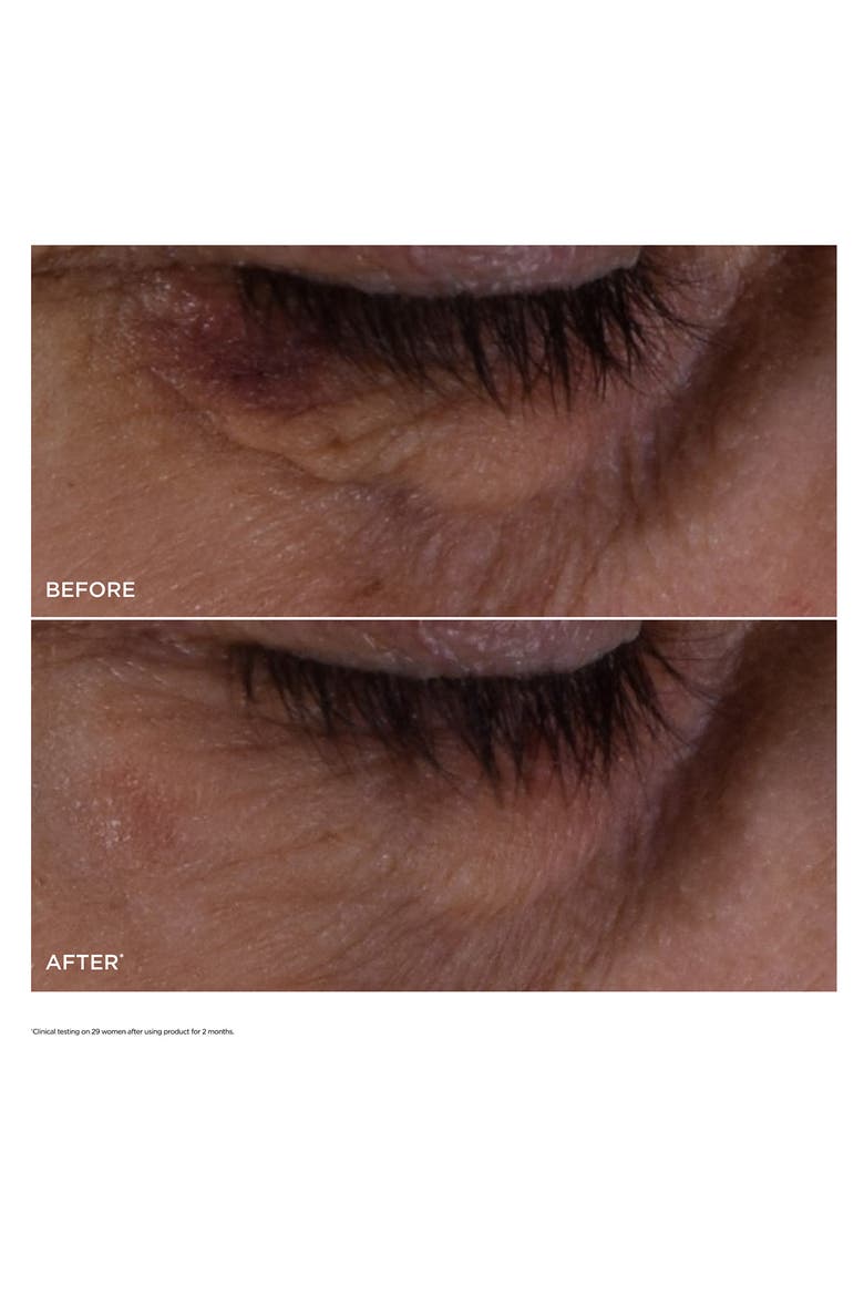 Double Serum® Eye Brightening & Depuffing Anti-Aging Concentrate, Alternate, color, NO COLOR