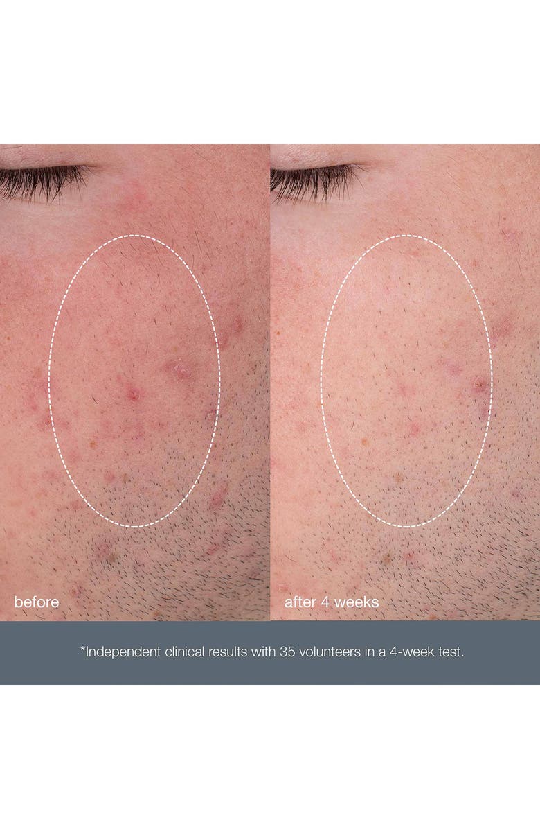 dermalogica<sup>®</sup> Daily Microfoliant<sup>®</sup>, Alternate, color, 