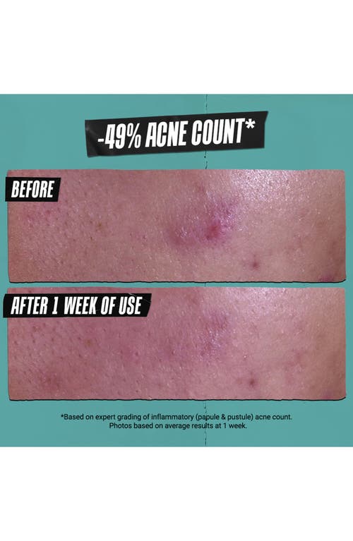 Kiehl's Since 1851 Gently Effective Acne-treating Cleansing Paste In Transparent