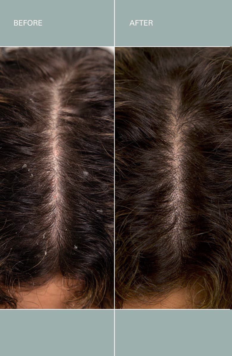 ROZ Salt Scalp Scrub, Alternate, color, 