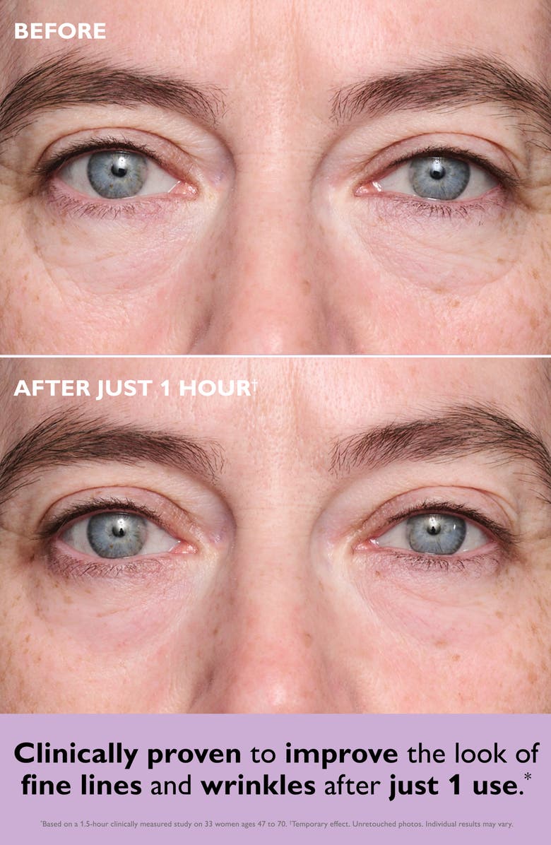 Peter Thomas Roth Instant FirmX Collagen-Infusion Tightening Eye Patches, Alternate, color, 