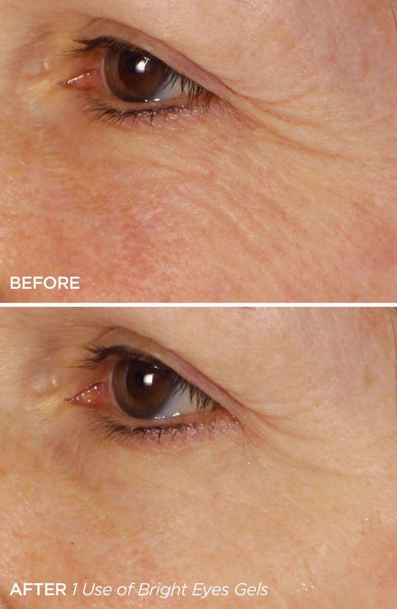 BeautyBio Treat Sleep Repeat Set, Alternate, color,