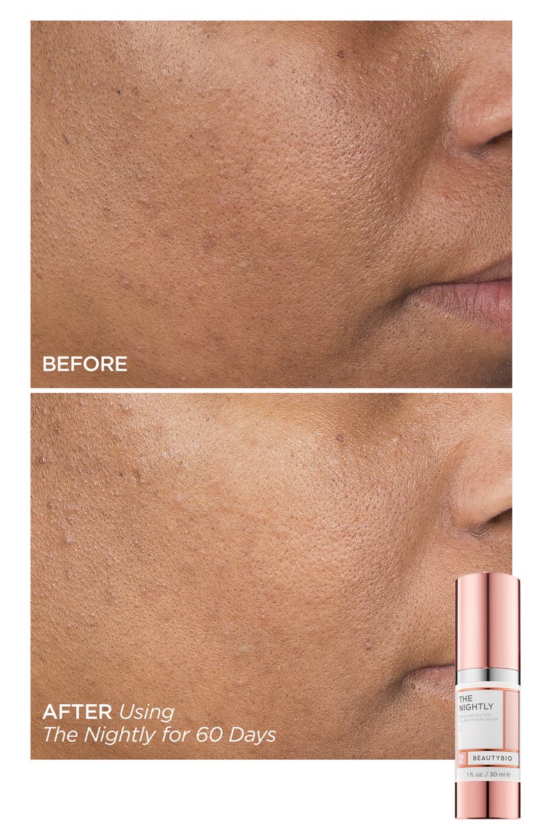 BeautyBio GloPRO Skin Care Set-$354 Value, Alternate, color,