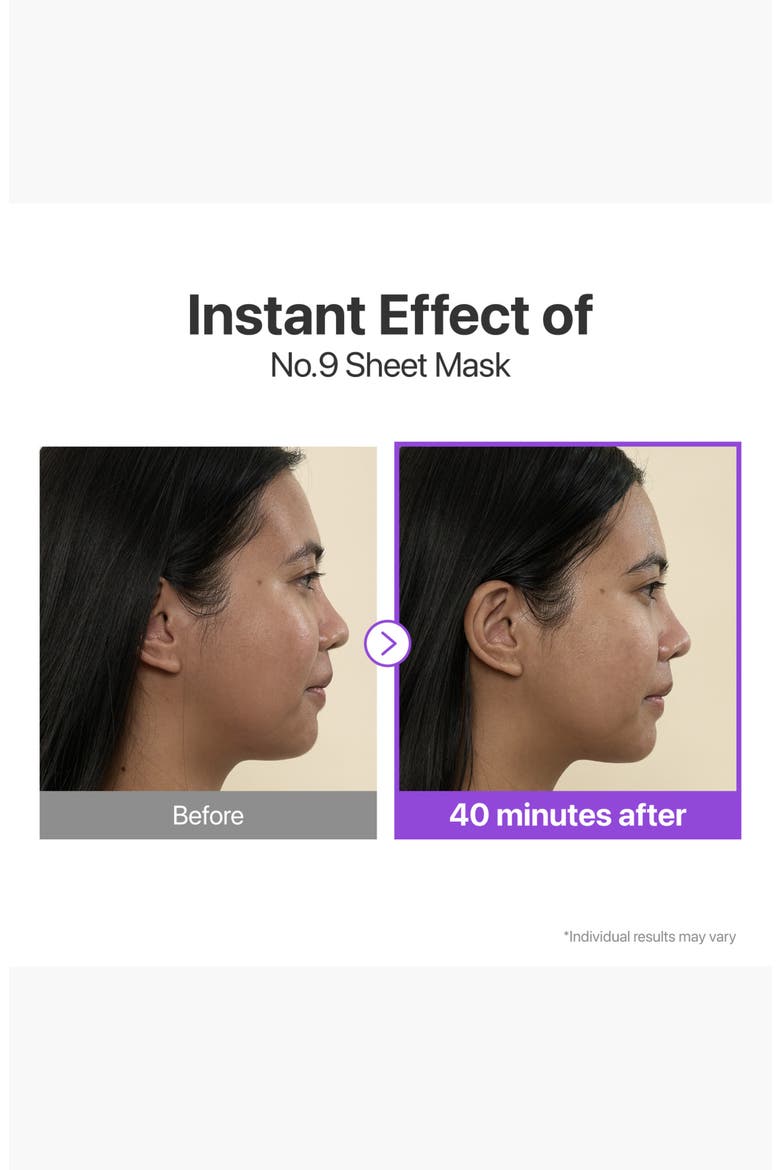 4-Pack No.9 NAD+ Bio Lifting-sil Full Face Mask & Lifting Band, Alternate, color, NO COLOR