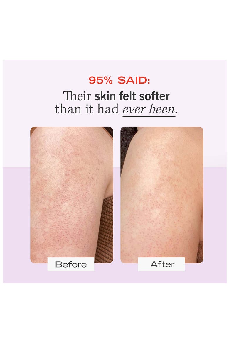 KP Bump Eraser Body Scrub Duo $60 Value, Alternate, color, NO COLOR