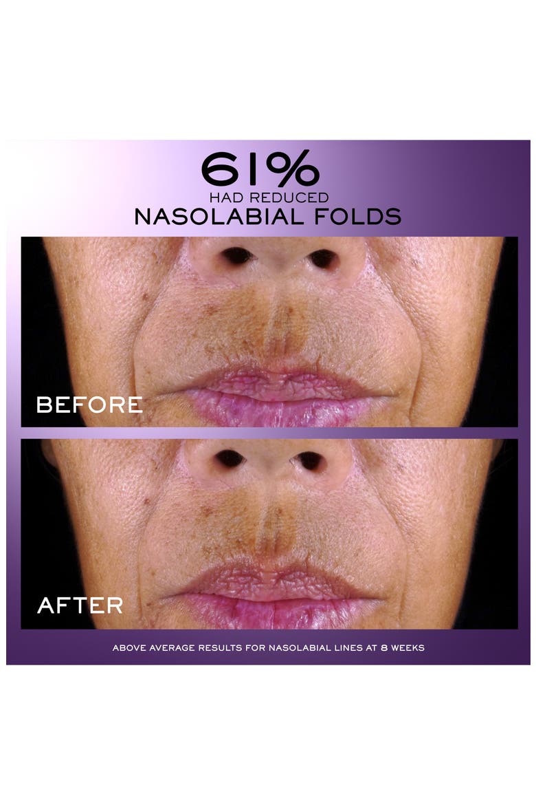 Rénergie C.R.x. Triple Serum Retinol, Alternate, color, NO COLOR
