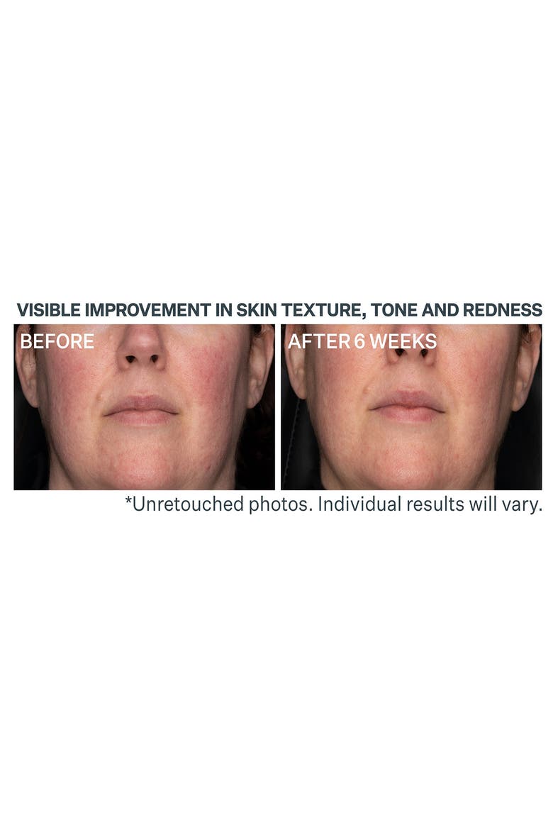 Advanced Retinol Daily Repair Moisturizer with SPF 30, Alternate, color, NO COLOR