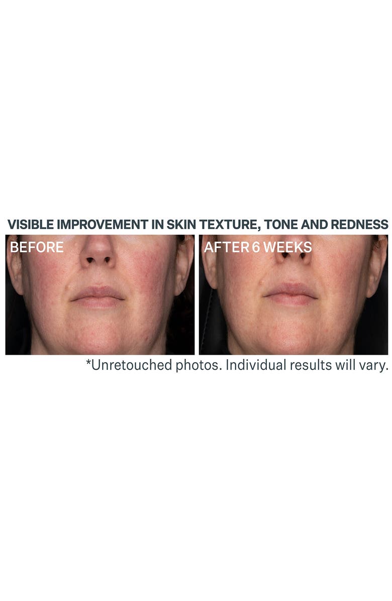 StriVectin<sup>®</sup> Advanced Retinol Daily Repair Moisturizer with SPF 30, Alternate, color,