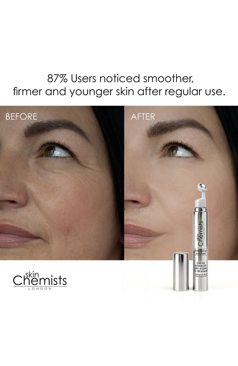 SKINCHEMISTS Caviar Advanced Anti-Ageing Eye Treatment 15ml for Loss of Firmness, Fine Lines & Wrinkles, Alternate, color, White