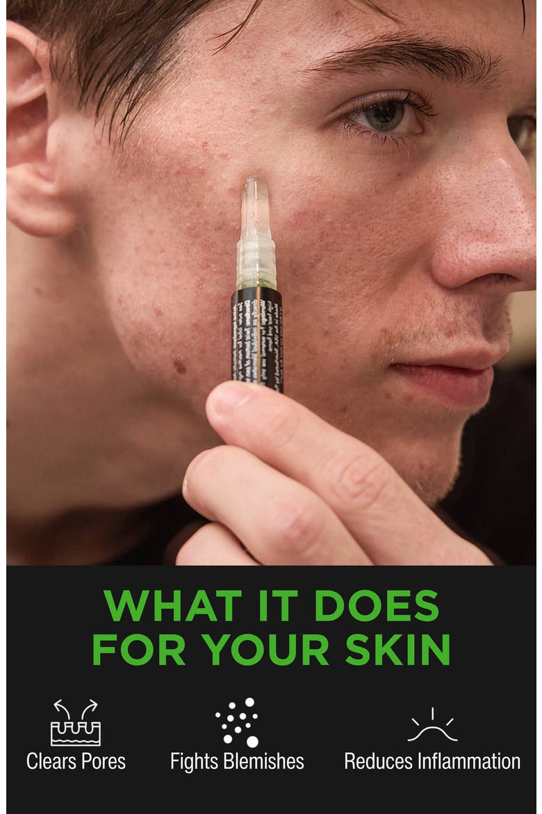 Salicylic Acid Acne Gel Pen, Alternate, color, NO COLOR