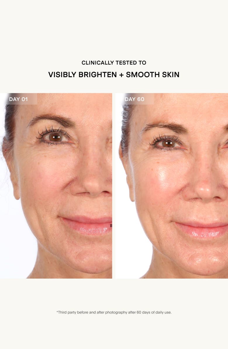 U Beauty Resurfacing Flash Peel Skin Care Treatment, Alternate, color, 