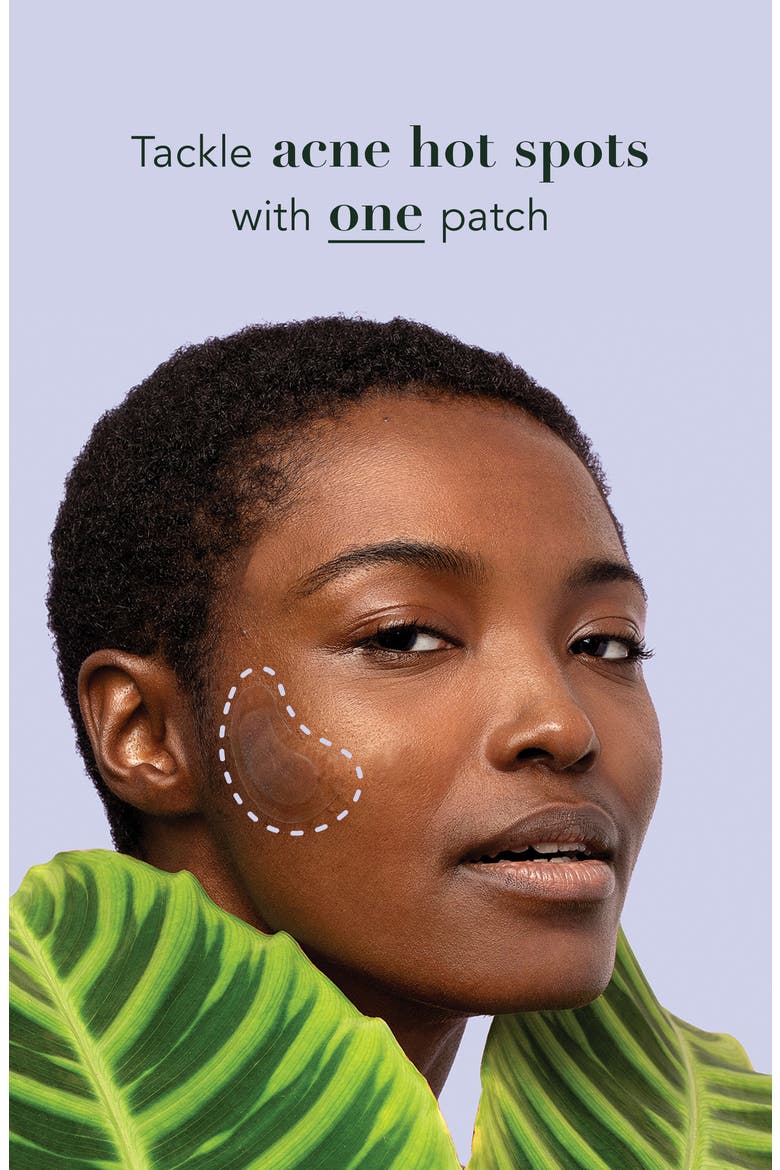Miracle Patch Spot Control Acne Cover Patches, Alternate, color, NO COLOR