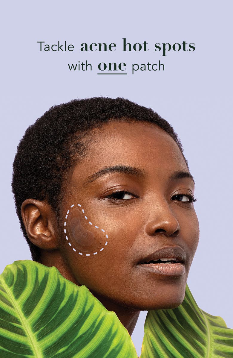 Rael Miracle Patch Spot Control Acne Cover Patches, Alternate, color,