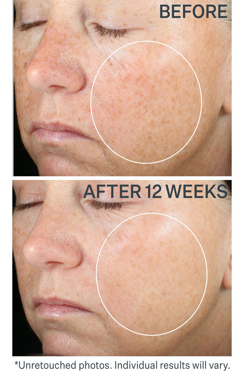 StriVectin<sup>®</sup> Super-C Brighten & Correct Serum, Alternate, color, 