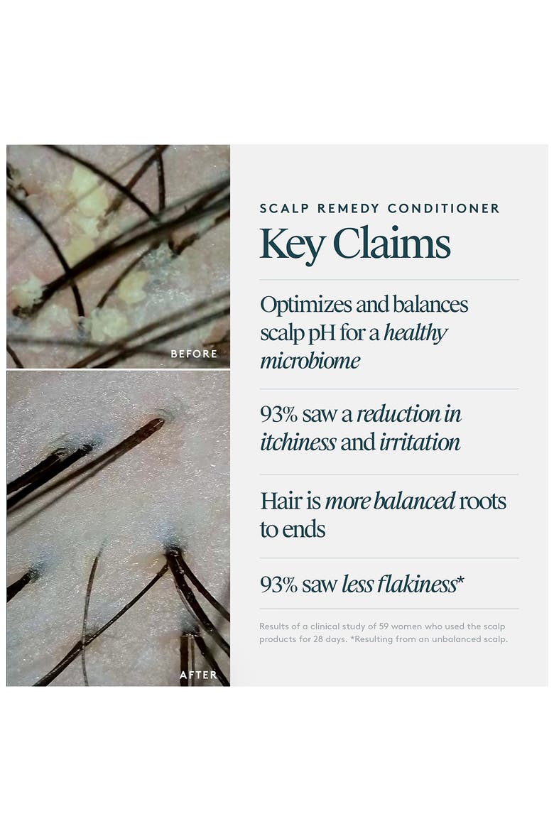 Scalp Remedy Conditioner, Alternate, color, NO COLOR