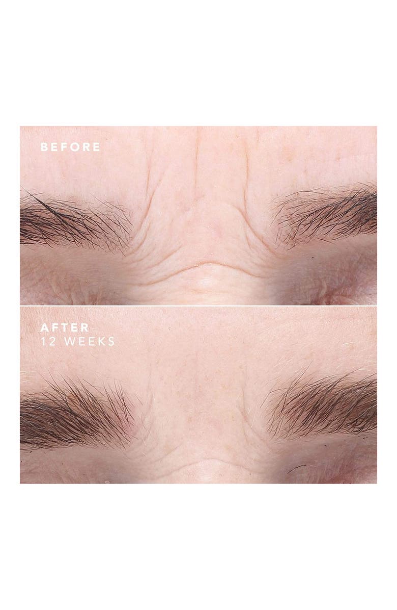 BIOEFFECT EGF Face Serum, Alternate, color, 