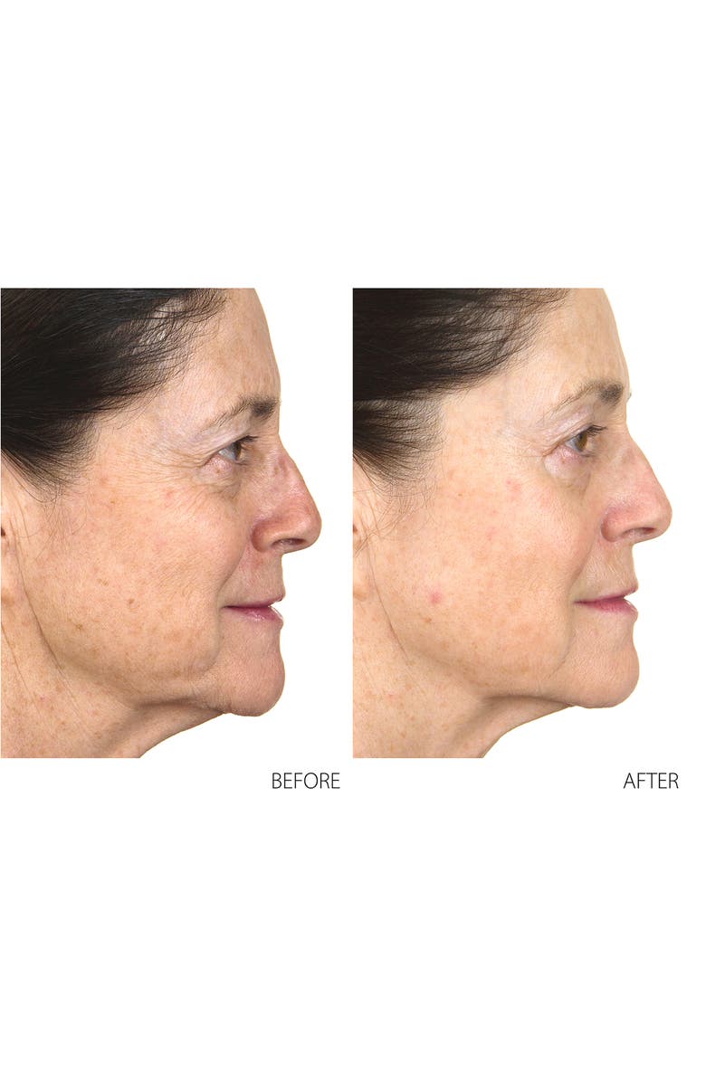 Conture Kinetic Skin Toning System, Alternate, color, 