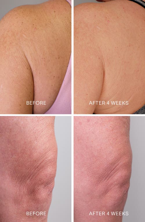 Doctor Rogers Body Repair Treatment Serum In No Color