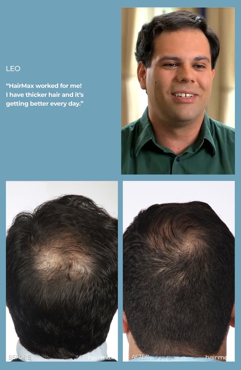 HAIRMAX <sup>®</sup> Ultima 12 LaserComb Hair Growth Device, Alternate, color, 