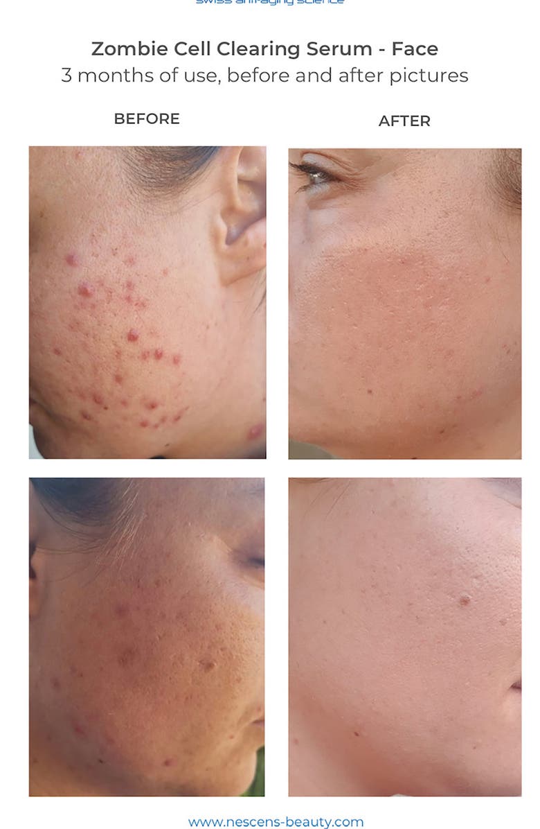 Nescens Zombie Cell Clearing Serum, Alternate, color,