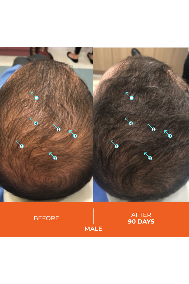 Revita Tablets For Hair Growth Support, Alternate, color, No Color