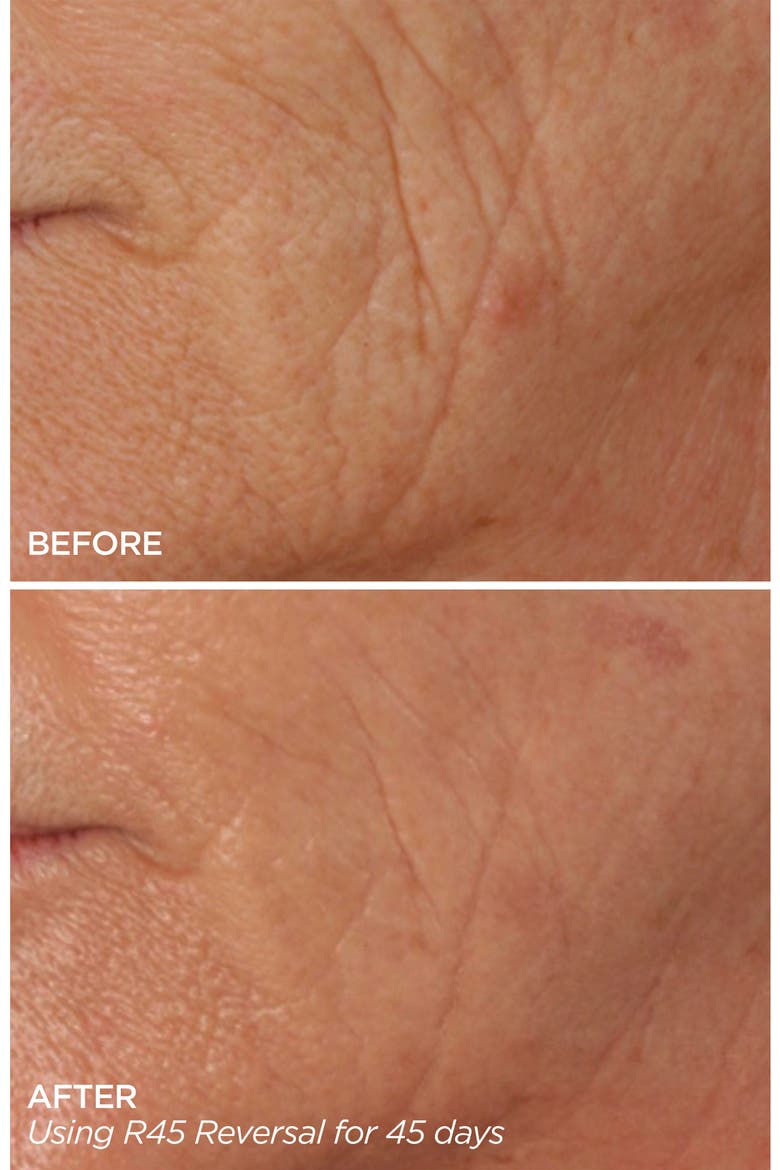R45 The Reversal 3-Phase Skin Transforming Treatment, Alternate, color, NO COLOR