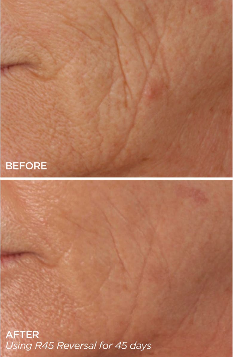 BeautyBio R45 The Reversal 3-Phase Skin Transforming Treatment, Alternate, color, 