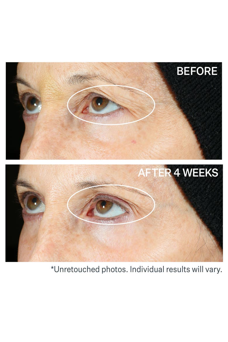 360° Tightening Eye Serum, Alternate, color, NO COLOR