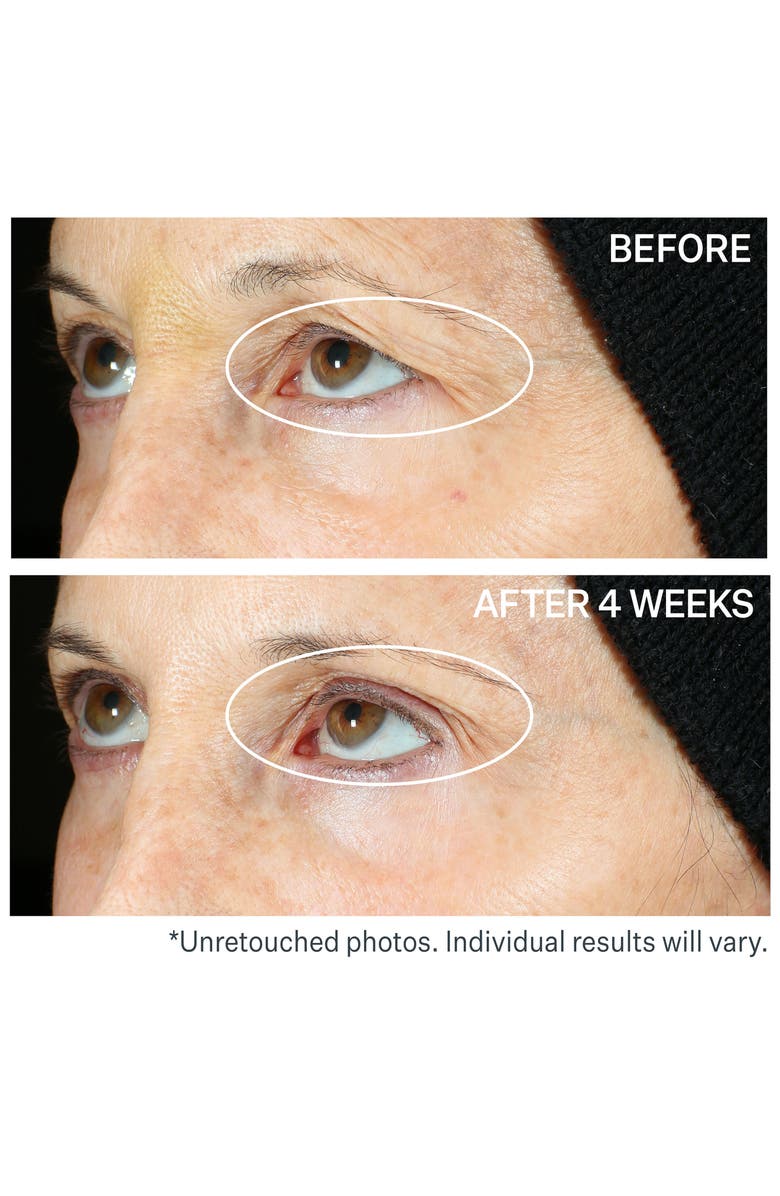 StriVectin<sup>®</sup> 360° Tightening Eye Serum, Alternate, color,