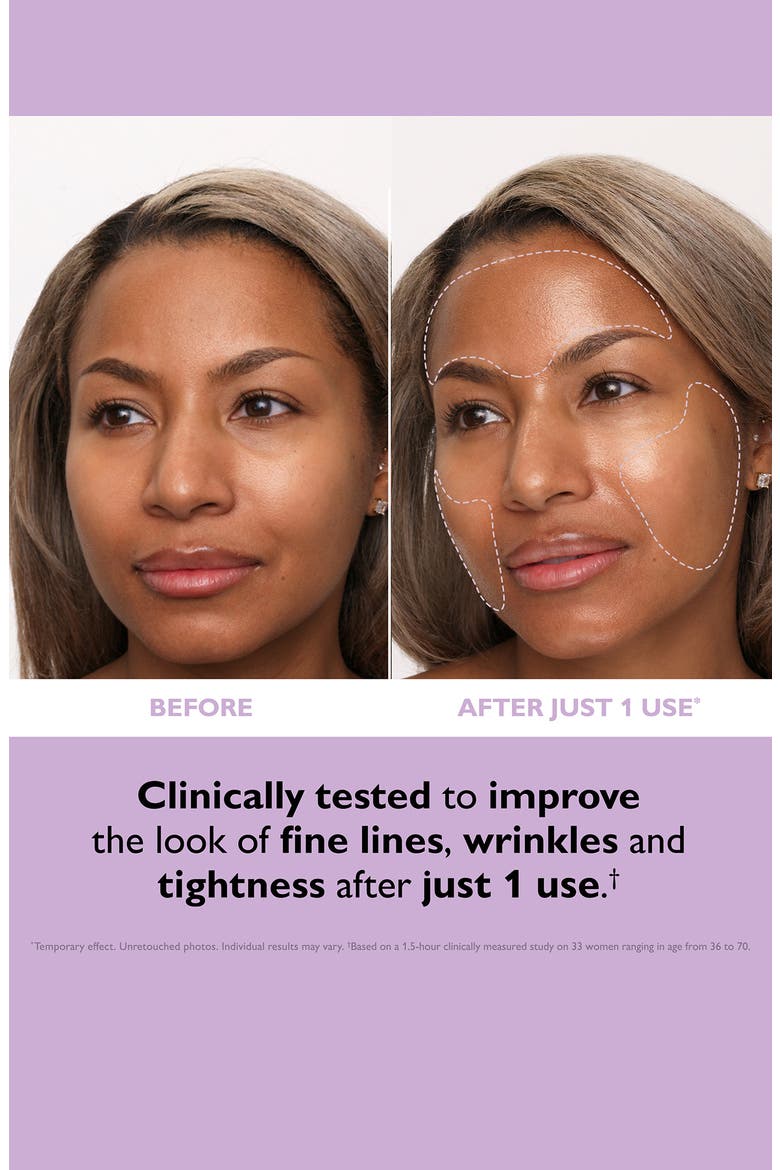 Intant Firmx® Collagen Tightening Face Patches, Alternate, color, NO COLOR