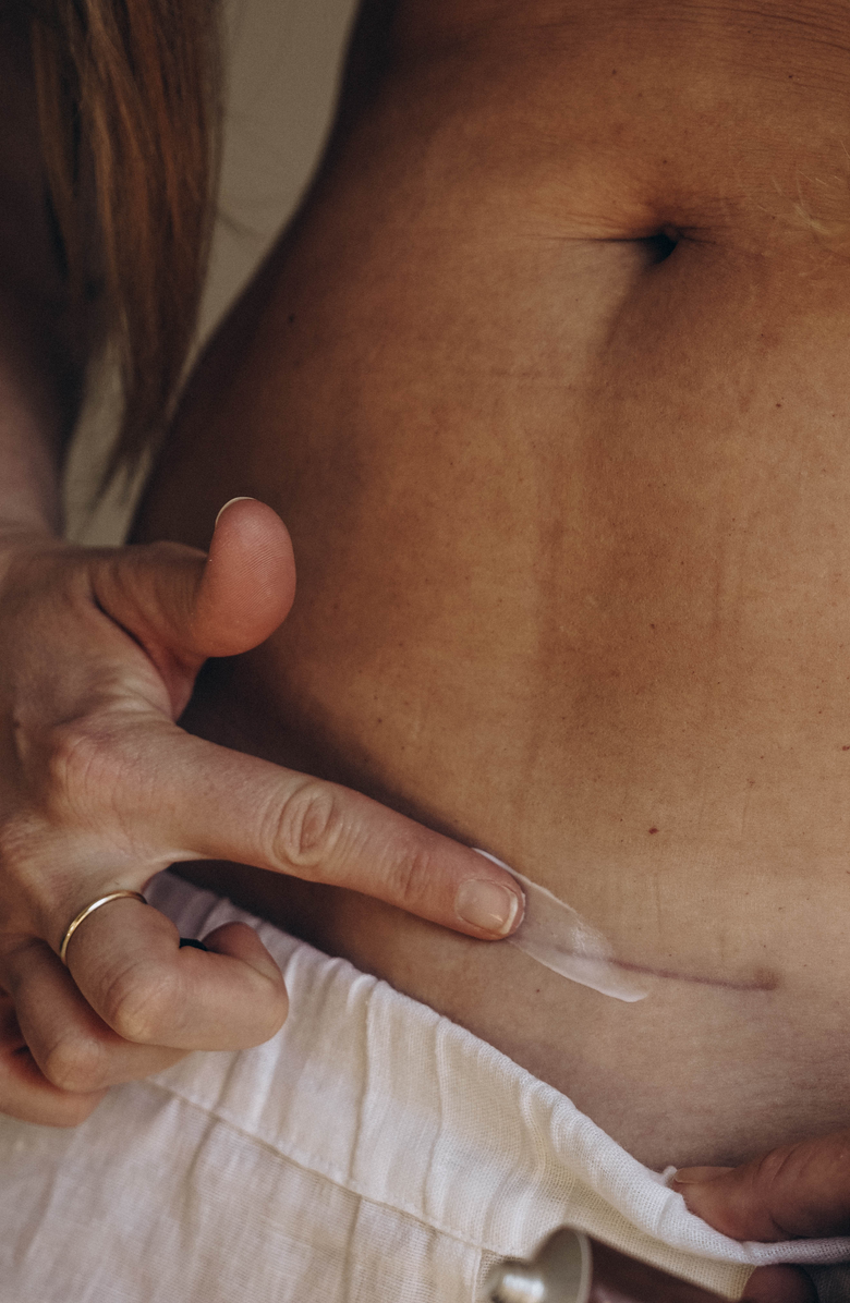 Nēmah Restorative Scar Treatment, Alternate, color, NO COLOR