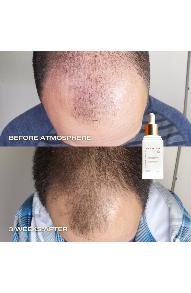 Luna Nectar Atmosphere Multi-Peptide Hair Density & Scalp Serum, Alternate, color, 1.69 Oz.