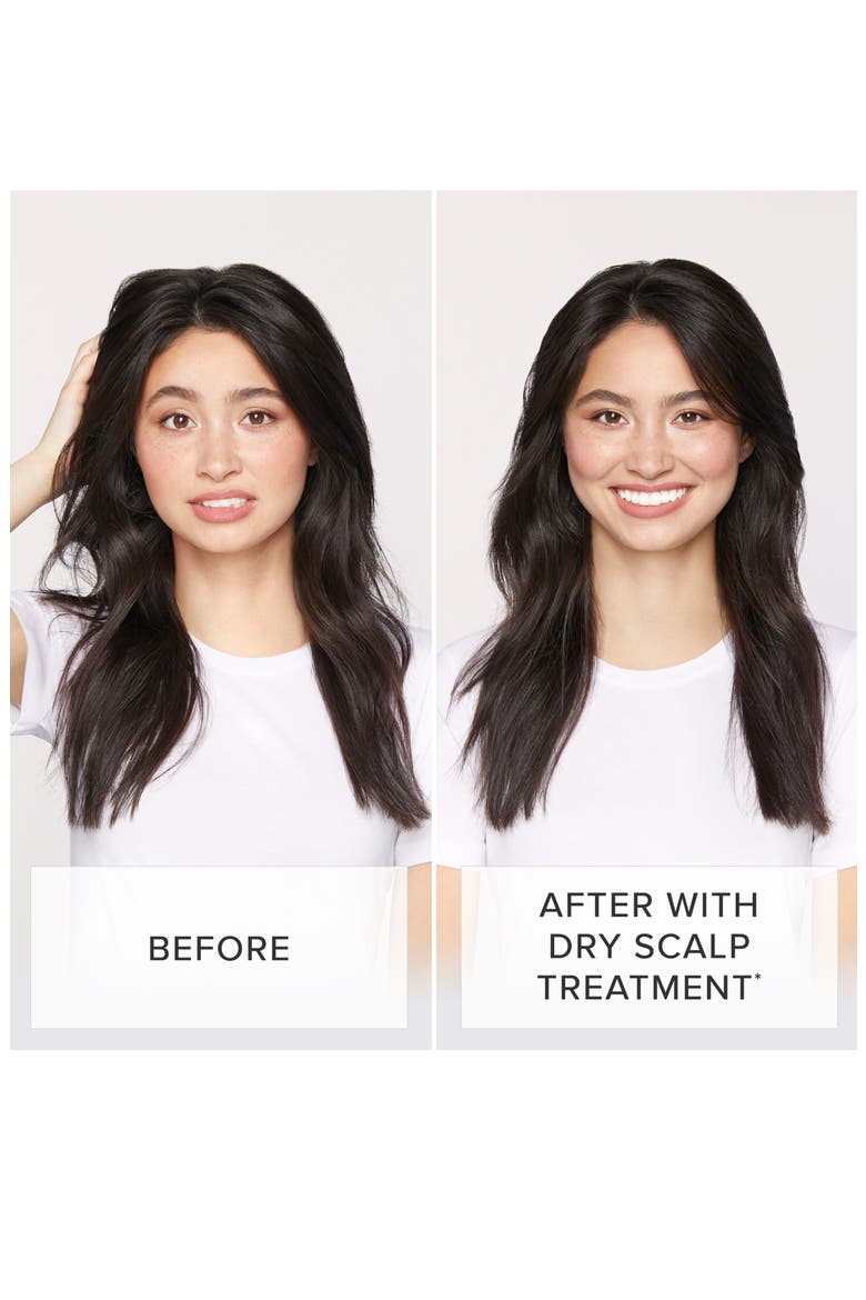 Restore Dry Scalp Treatment, Alternate, color, NO COLOR