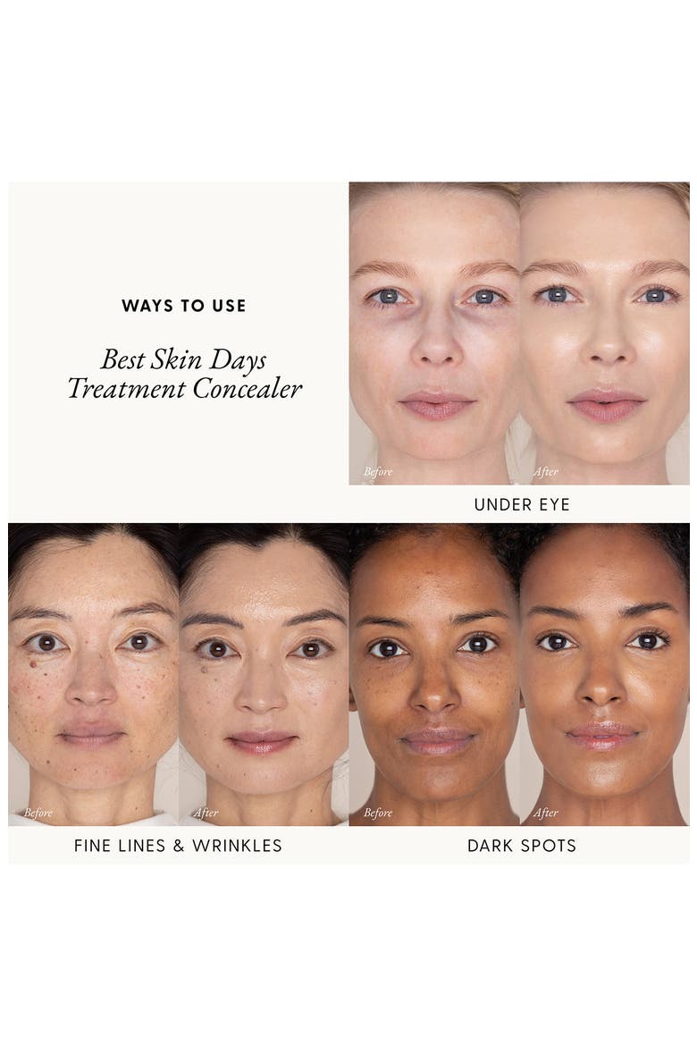 Best Skin Days™ Treatment Concealer, Alternate, color, SHADE 9