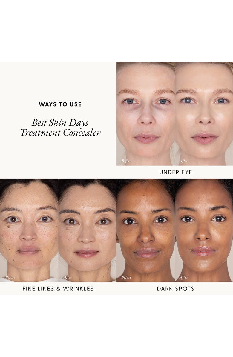 Best Skin Days<sup>™</sup> Treatment Concealer