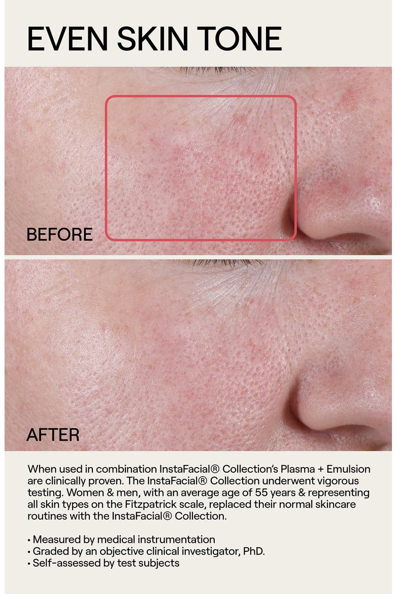 Instafacial® Plasma Bioactive Growth Factor Serum, Alternate, color, NO COLOR