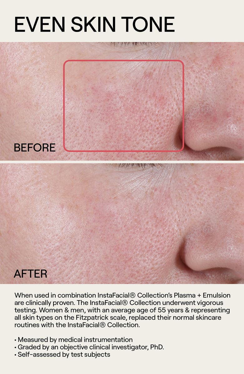 Dr. Diamond's Metacine InstaFacial<sup>®</sup> Emulsion Retinopro Growth Factor Night Cream, Alternate, color, 