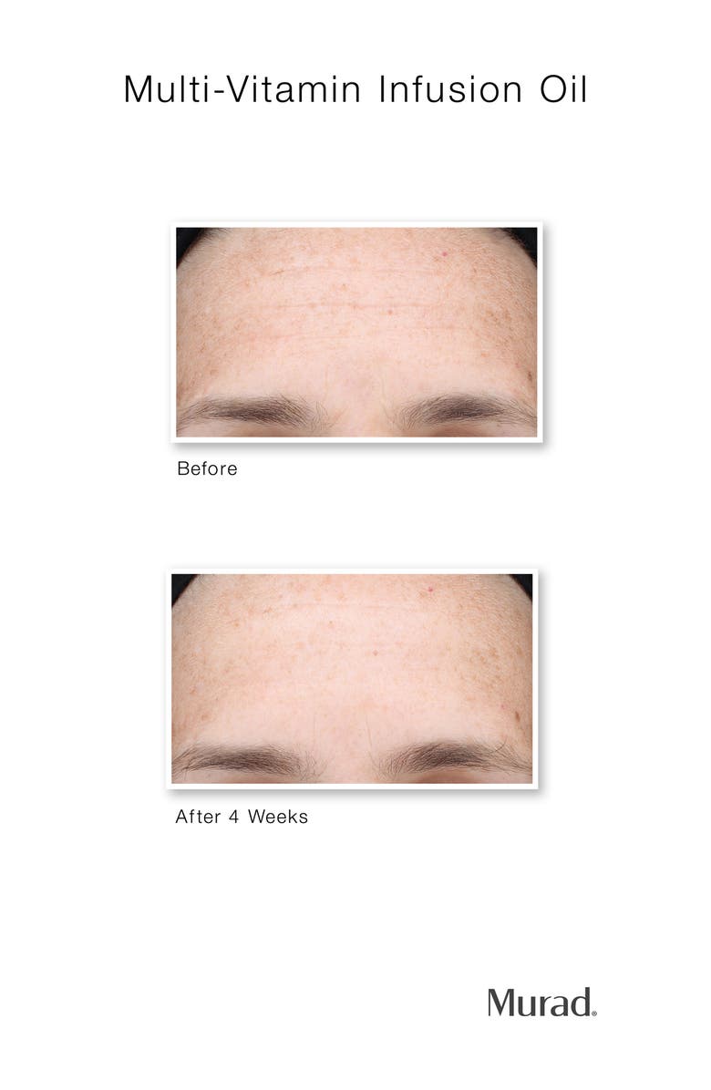 Murad<sup>®</sup> Hydrate Discovery Skin Care Set, Alternate, color,