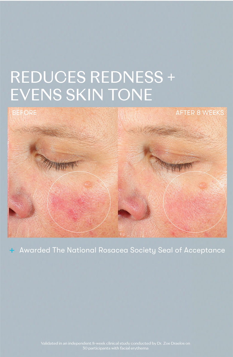 RescueMD Skin Longevity Nighttime Oil, Alternate, color, NO COLOR