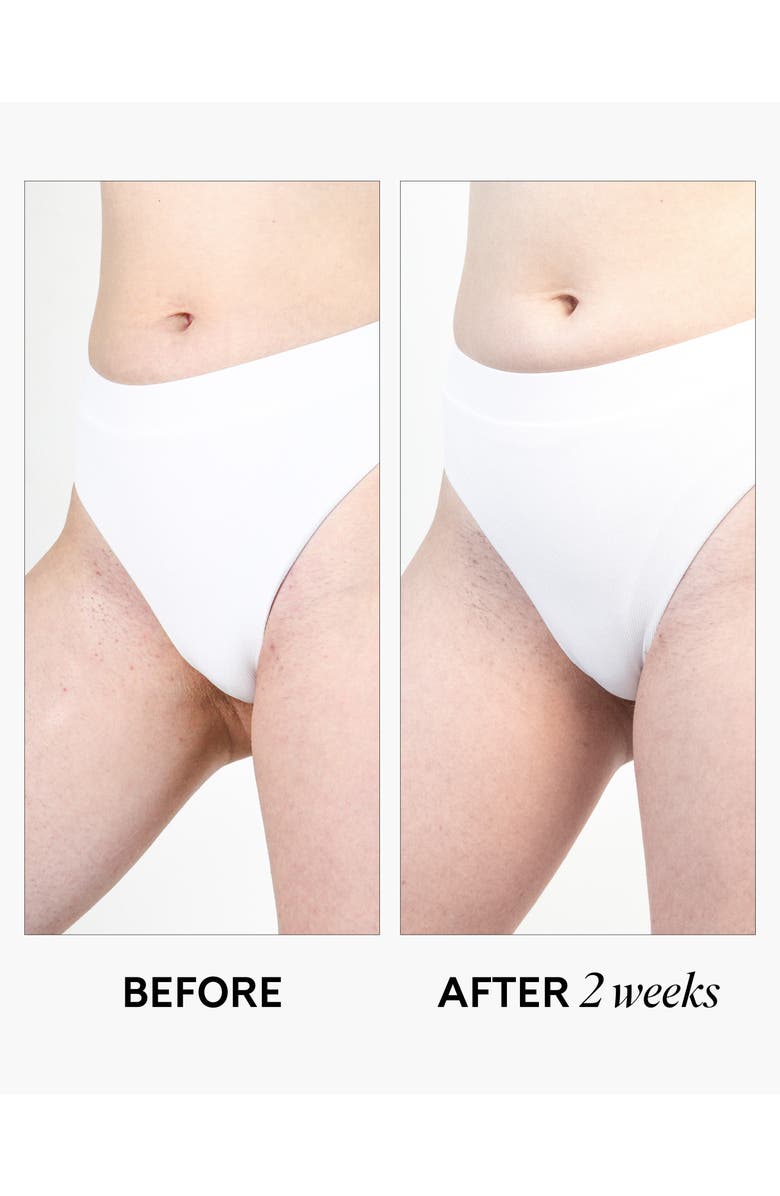 Fur Skincare Ingrown Eliminator Serum, Alternate, color, 