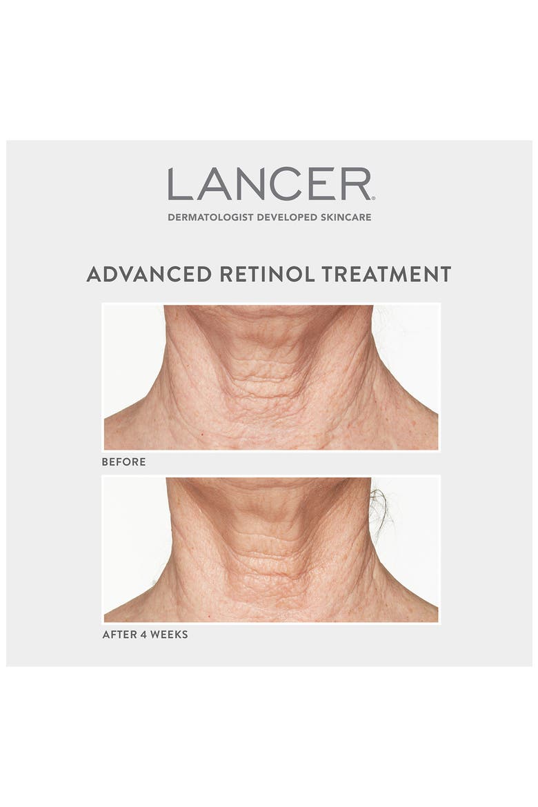 Advanced Retinol Treatment, Alternate, color, NO COLOR