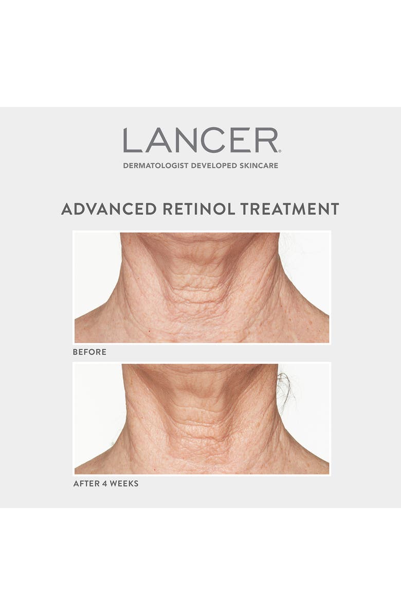 LANCER Skincare Advanced Retinol Treatment, Alternate, color,